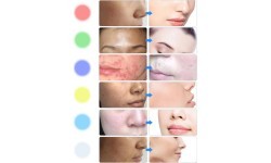 LED Light Therapy Facial Machine inSPORTline Coladome 600