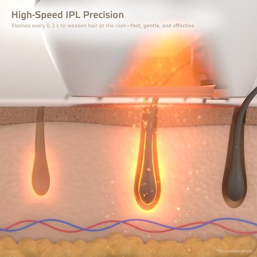 IPL Epilator inSPORTline Aphira