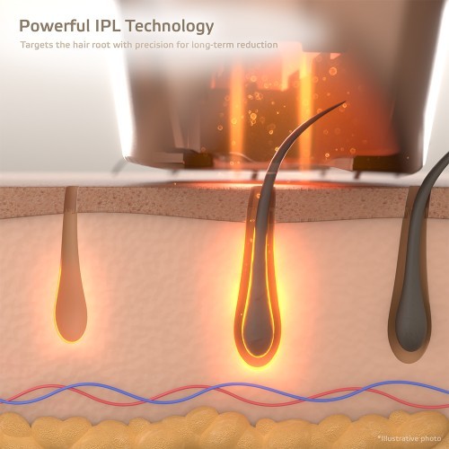 IPL epilators inSPORTline Eriva