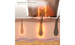 IPL Epilator inSPORTline Eriva