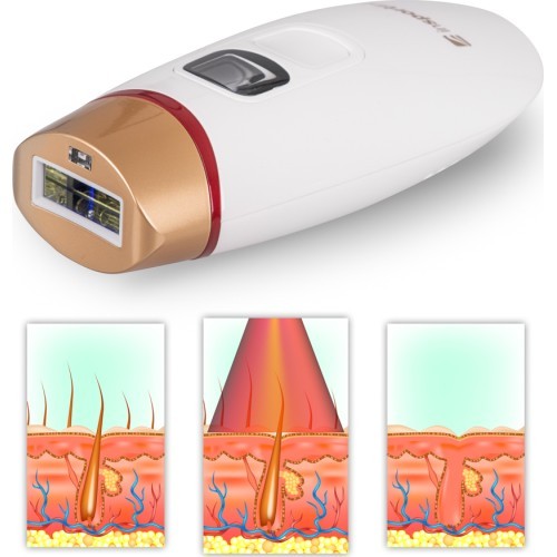 IPL epilators inSPORTline Eriva