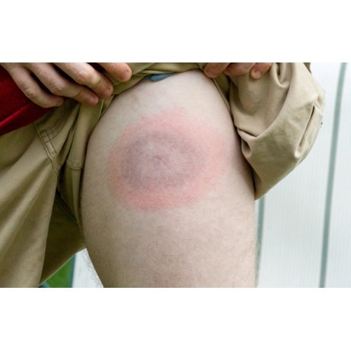 Mugga soothing lotion for bites and burns 50